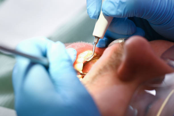 Best Weekend Emergency Dentist in Erma, NJ