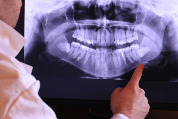Best Emergency Dentist for Lost Fillings or Crowns in Erma, NJ