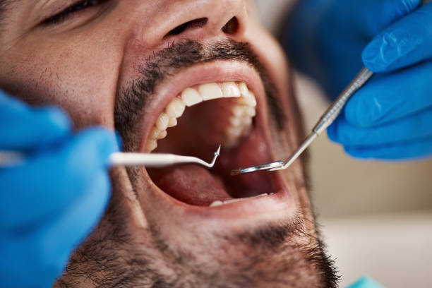 Best Emergency Dental Services for Seniors in Erma, NJ