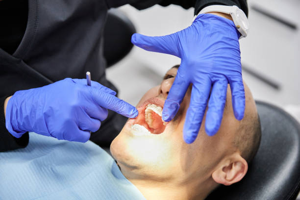 Best Broken or Cracked Tooth Emergency Dentist in Erma, NJ