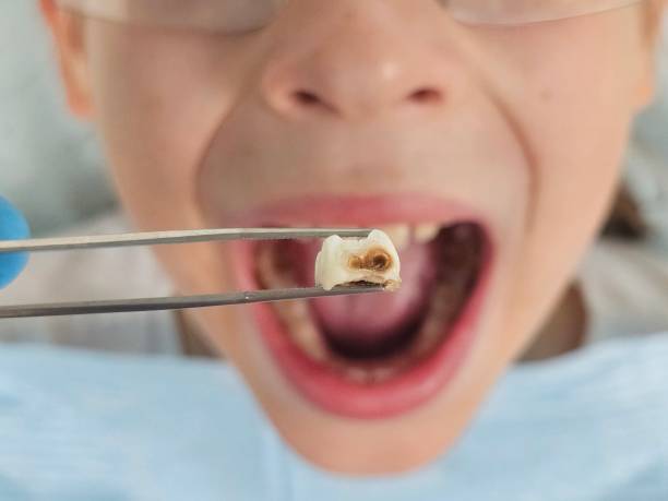 Best Emergency Dentist for Knocked-Out Tooth in Erma, NJ